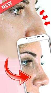 Nose Plastic Surgery 1 تصوير الشاشة