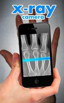 X-Ray Camera Fingers screenshot 1