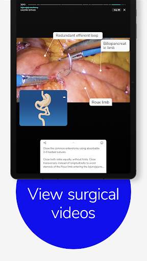 Touch Surgery: Surgical Videos screenshot 13