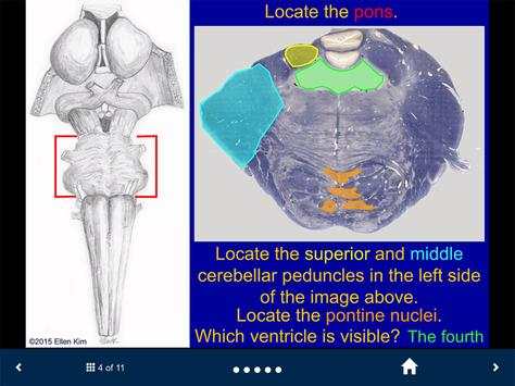 Neuroanatomy Lite - SecondLook screenshot 5