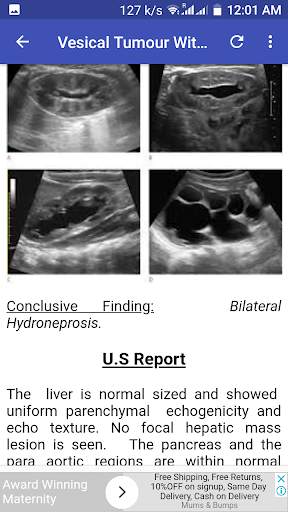 Ultrasound Guide A2Z 15 تصوير الشاشة