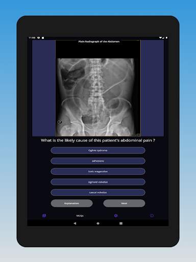 Basic Radiology for medical students screenshot 8