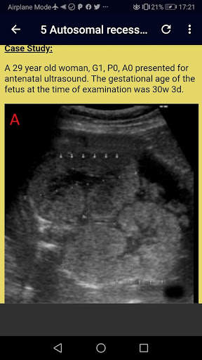 Ultrasound Complete Guide screenshot 6