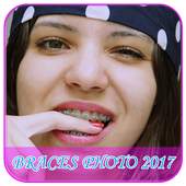 Braces Photos 1.0