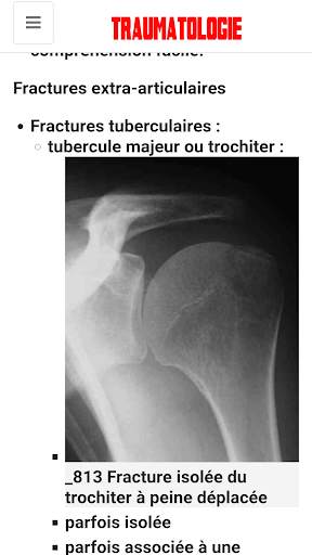Traumatologie скриншот 8
