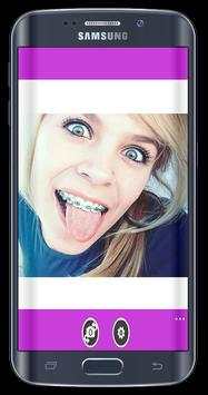 Top Design Braces teeth screenshot 3