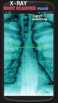 X-ray cloth Scanner Prank screenshot 3