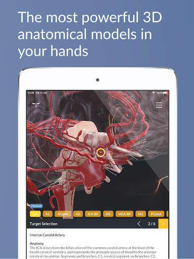 UpSurgeOn Neurosurgery screenshot 12
