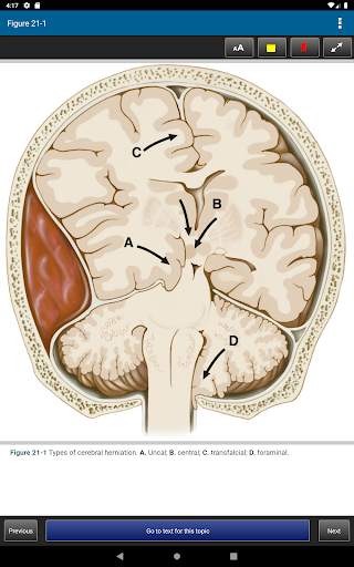 Harrison's Manual of Medicine 20th Edition screenshot 22
