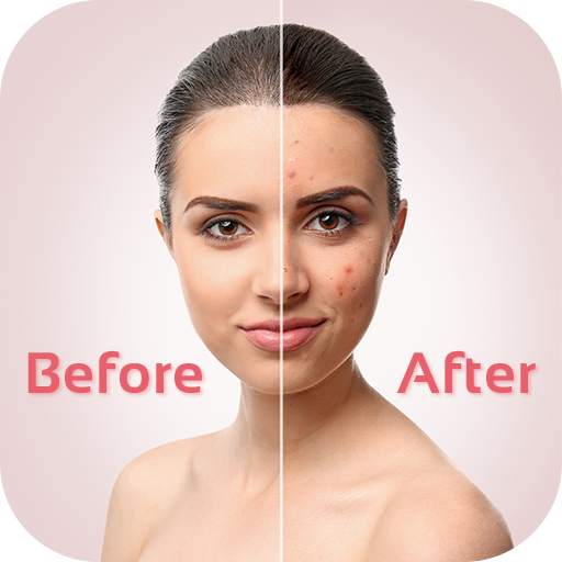 face blemishes removal-Smooth Skin & Beautify Face 1.3