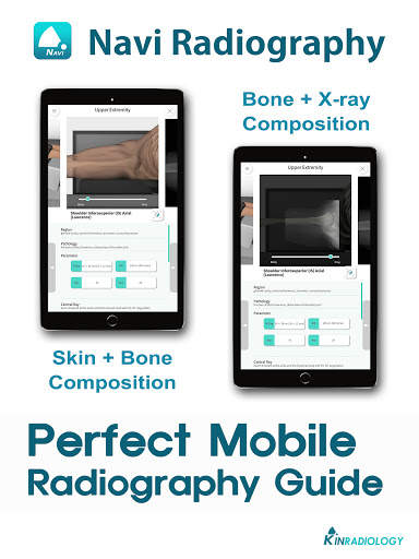 Navi Radiography Lite screenshot 3