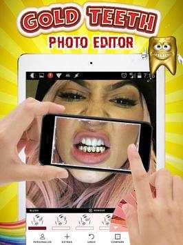 Gold Teeth Photo Editor screenshot 1
