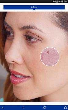 SkinBetter 6 تصوير الشاشة