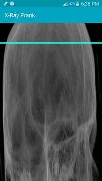 X Ray Scanner Prank screenshot 1