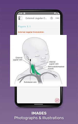 Harriet Lane Handbook App screenshot 11