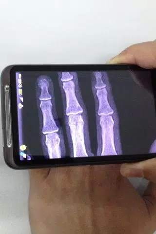 Xray Scanner screenshot 1