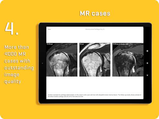 MRI Essentials screenshot 11