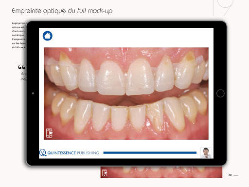 Quintessence Koubi screenshot 2