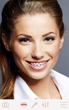 Braces screenshot 2