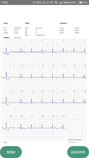 ECG mob screenshot 6