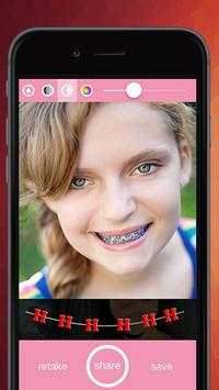 Braces- HD Camera Braces Booth screenshot 1