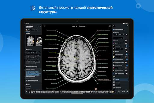 e-Anatomy скриншот 13