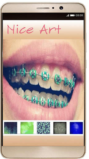 Braces Photo Editor - Braces For Your Teeth screenshot 2