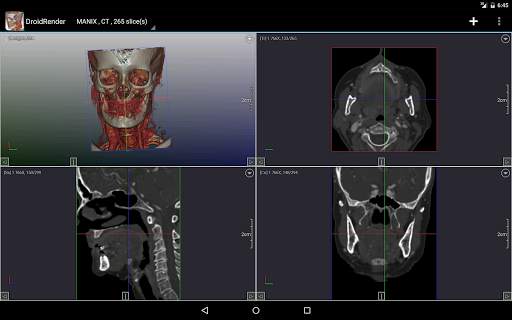 DroidRender - 3D DICOM viewer स्क्रीनशॉट 13