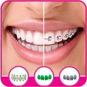 Braces Camera Editor 1.0