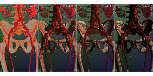 DroidRender - 3D DICOM viewer स्क्रीनशॉट 15