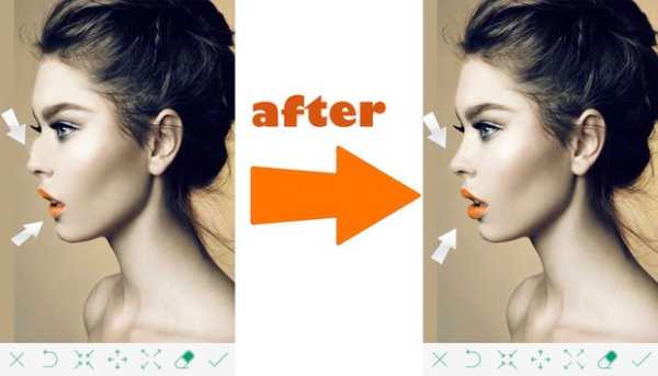 Slim body plastic surgery screenshot 2