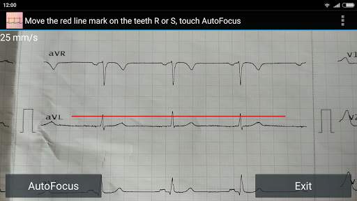 ECG Reader free screenshot 3