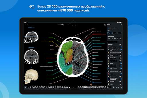 e-Anatomy скриншот 10