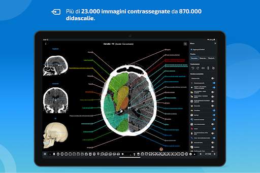 e-Anatomy screenshot 10