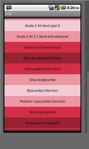 Electrocardiogram ECG Types screenshot 2