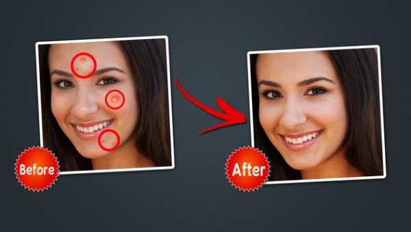 Object Remover -Erase Object -Face Blemish Remover screenshot 16