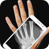 Body Scanner New Xray Real Cloth Camera Prank App 1.1