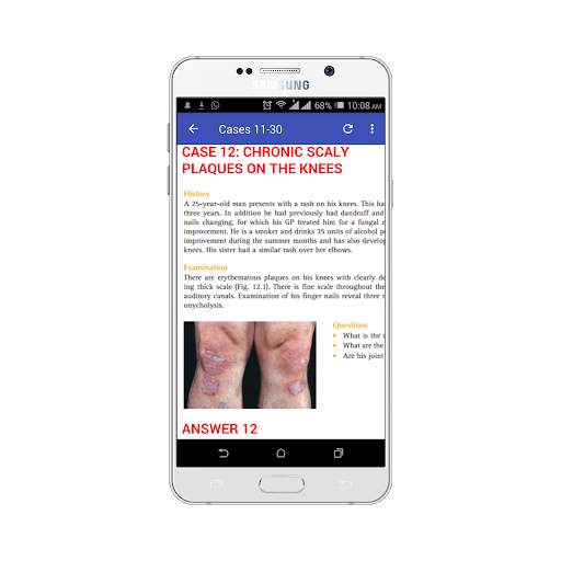 100 Cases In Dermatology screenshot 2