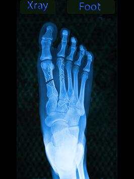 Real X Ray Body Scanner Prank: X Ray App screenshot 3