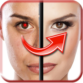 Red Eye Remover أيقونة