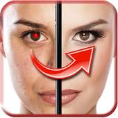 Red Eye Remover 1.5