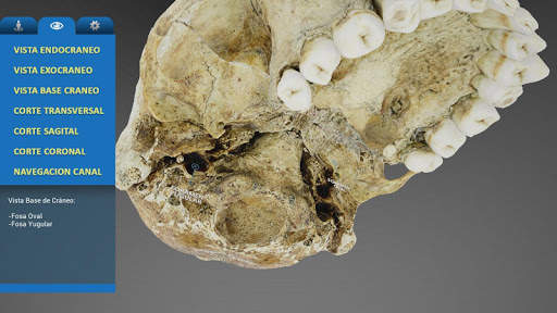 UC MedApp Craneo 3D screenshot 5