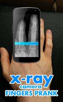 X-Ray Camera Fingers screenshot 2