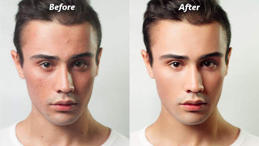 Pimple Eraser Photo Editor screenshot 3