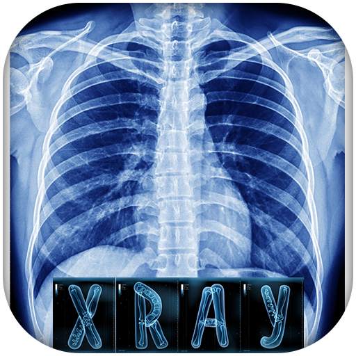 Chest X-ray interpretation 1.0