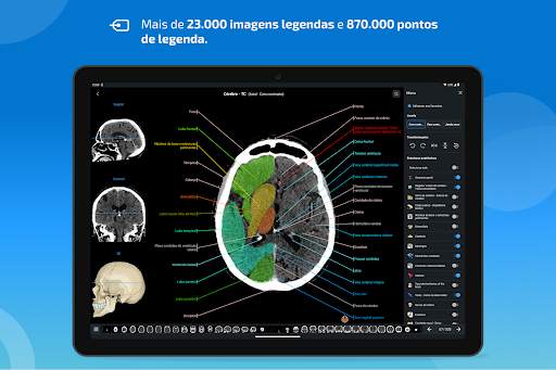 e-Anatomy screenshot 10