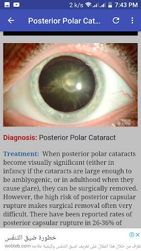 Ophthalmology & Optometry Guide screenshot 5
