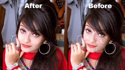 Pimples removing photo editing screenshot 3