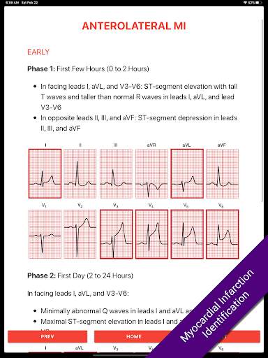 ECG FlashCards 2 Lite - Free Reference EKG App screenshot 5