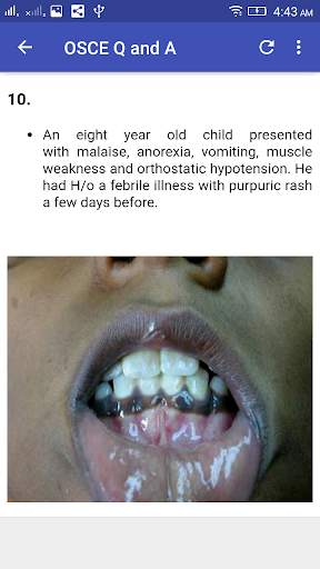 Pediatrics  OSCE Q and A screenshot 4